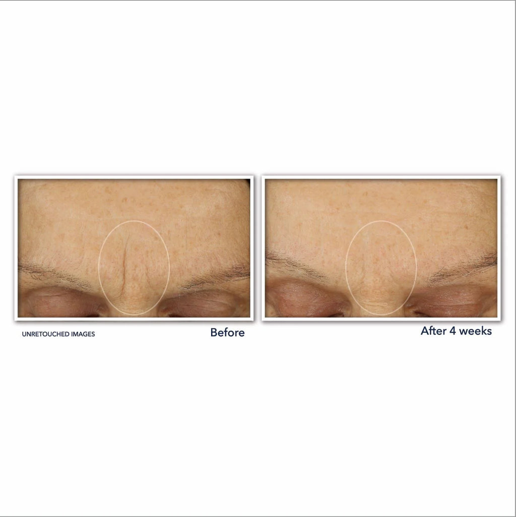 Retinol Anti-Aging Cream with Hyaluronic Acid, Fragrance-Free 1.7 oz W350405